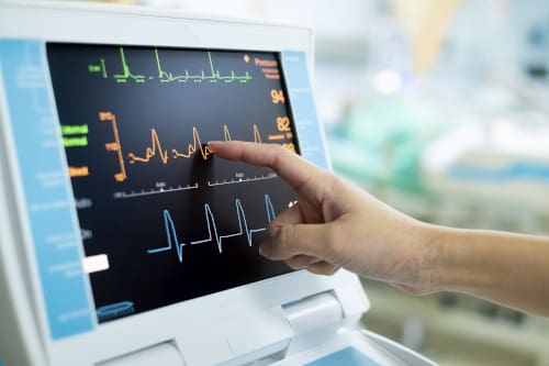 The screen of a medical monitoring device showing a heart rate