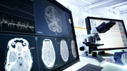 Exploring the Uses of MRI Scans - CNI College